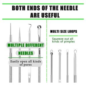 Blackhead removal kit.